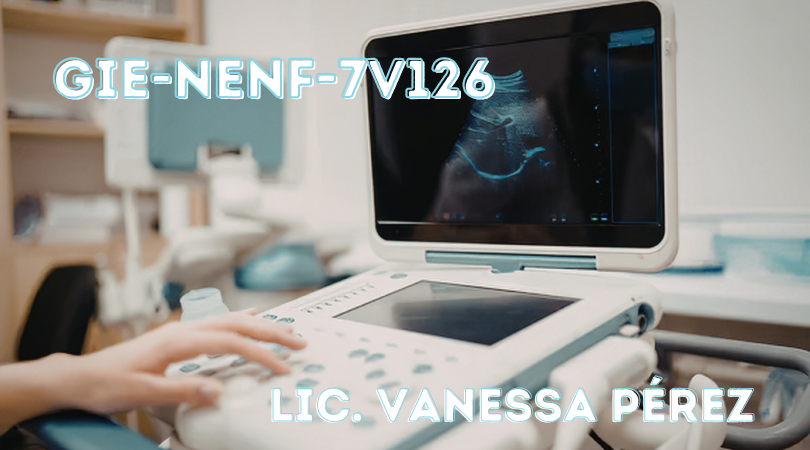 Protegido: GIE-NENF-7V126